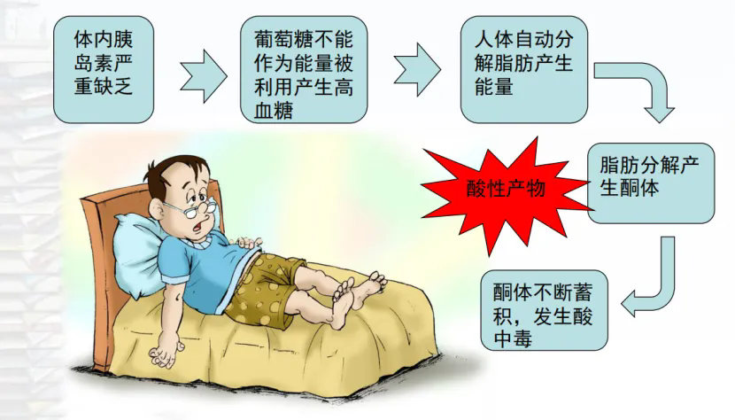 酮癥原理.png